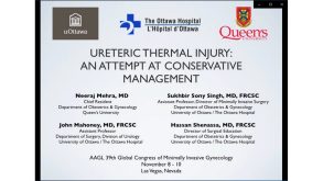 Ureteric Thermal Injury An Attempt at Conservative Management