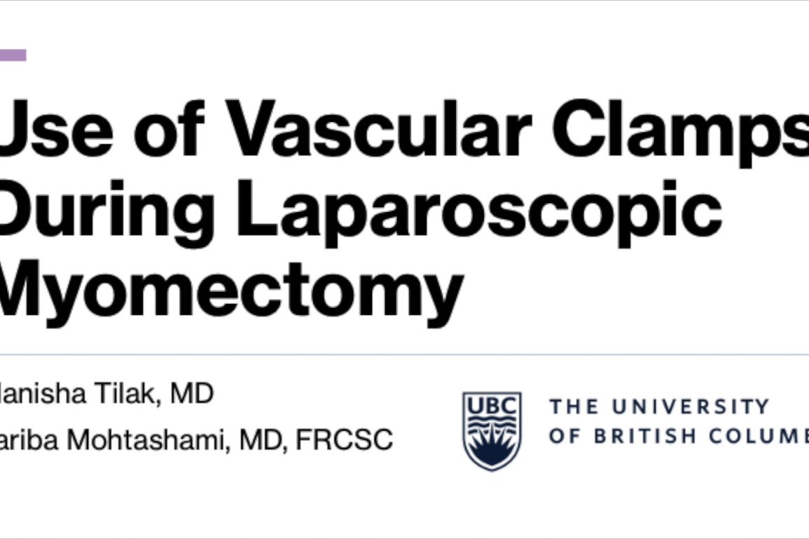 Use of Vascular Clamps During Laparoscopic Myomectomy