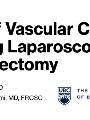 Use of Vascular Clamps During Laparoscopic Myomectomy