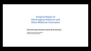 septum anomaly vagina uterus hysteroscopy septoplasty