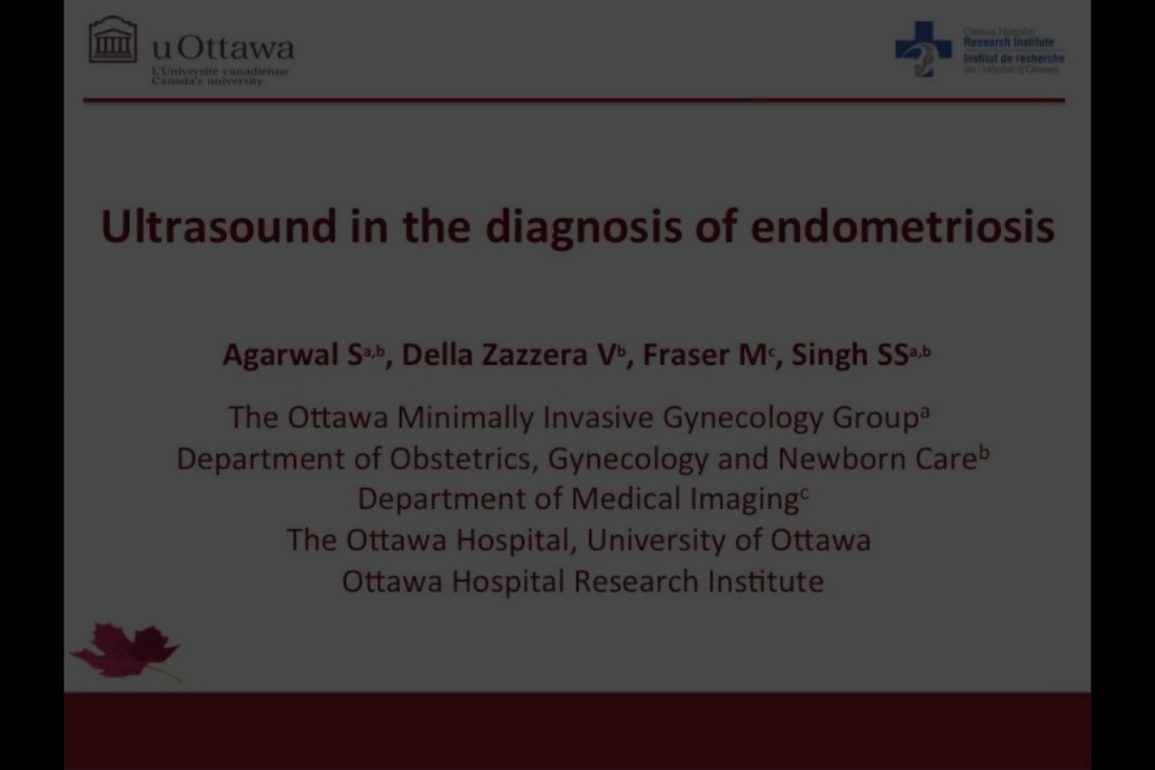 Ultrasound in the Diagnosis of Endometriosis