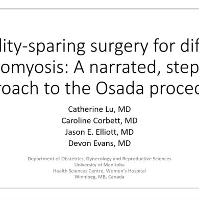 This video describes a narrated, stepwise approach to the Osada procedure fertility-sparing surgery for severe adenomyosis.