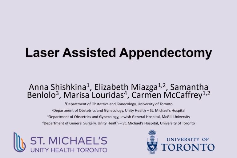 Laser Assisted Appendectomy