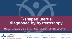 T-shaped uterus diagnosed by hysteroscopy