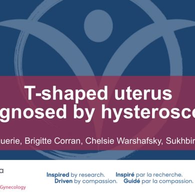 T-shaped uterus diagnosed by hysteroscopy