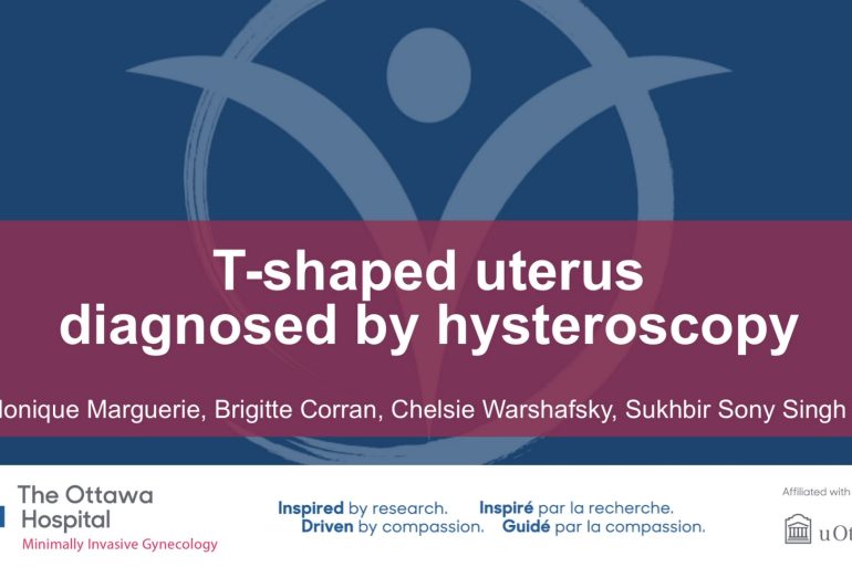 T-shaped uterus diagnosed by hysteroscopy