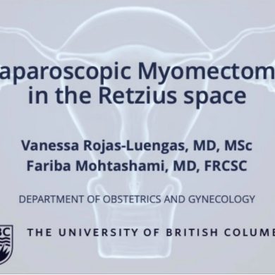 Laparoscopic Myomectomy in the Retzius Space