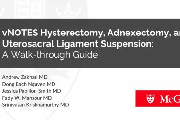 vNOTES Hysterectomy, Adnexectomy and Uterosacral Ligament Suspension: A Walk-through Guide