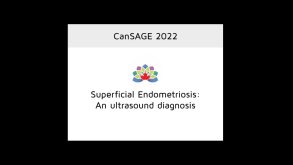 Superficial Endometriosis: An Ultrasound Diagnosis