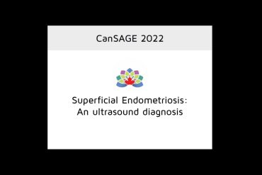 Superficial Endometriosis: An Ultrasound Diagnosis