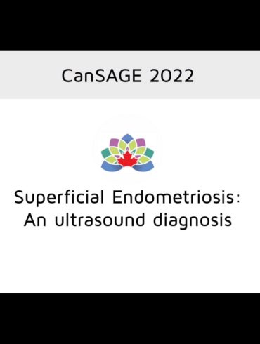 Superficial Endometriosis: An Ultrasound Diagnosis