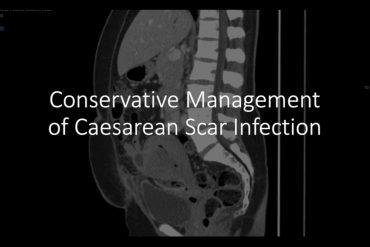 Conservative Management of Caesarean Scar Infection