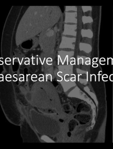 Conservative Management of Caesarean Scar Infection