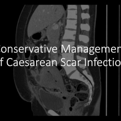 Conservative Management of Caesarean Scar Infection