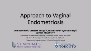 Approach to Vaginal Endometriosis