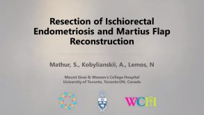 Resection of Ischiorectal Endometriosis and Martius Flap Reconstruction