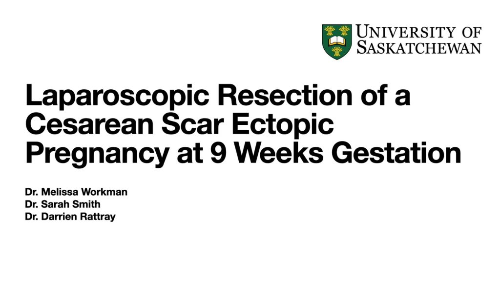 laparoscopic-wedge-resection-of-a-cesarean-scar-ectopic-pregnancy-at-9