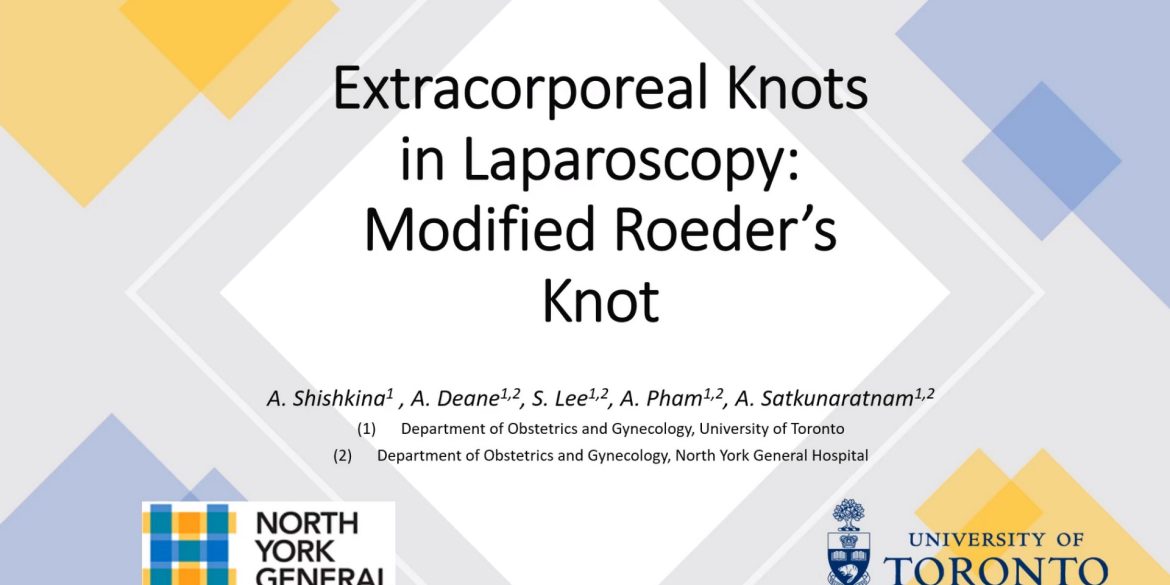 Extracorporeal Knots in Laparoscopy: Modified Roeder's Knot 11 Extracorporeal Knots in Laparoscopy: Modified Roeder's Knot