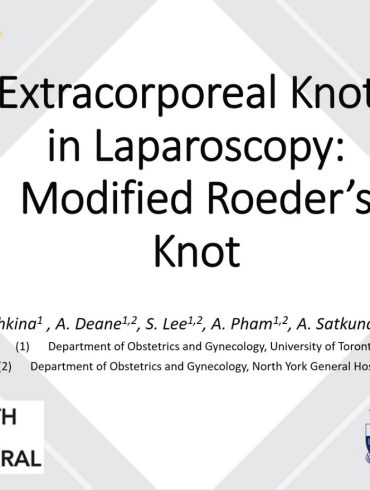 Extracorporeal Knots in Laparoscopy: Modified Roeder's Knot