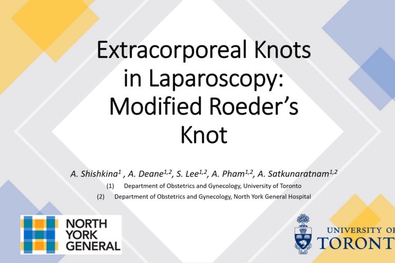Extracorporeal Knots in Laparoscopy: Modified Roeder's Knot