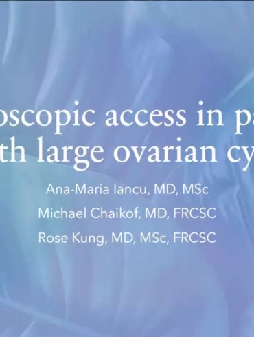 Laparoscopic access in patients with large ovarian cysts