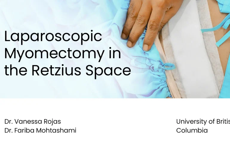 Laparoscopic Myomectomy in the Retzius Space
