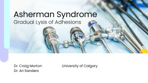 Asherman Syndrome Gradual Lysis of Adhesions