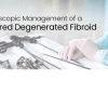 Laparoscopy: Addressing Ruptured Fibroids