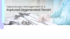 Laparoscopy: Addressing Ruptured Fibroids 88 Laparoscopy: Addressing Ruptured Fibroids