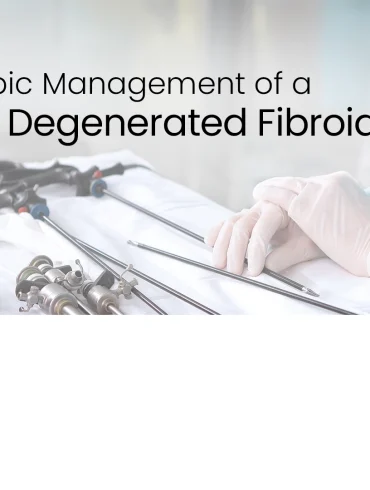 Laparoscopy: Addressing Ruptured Fibroids