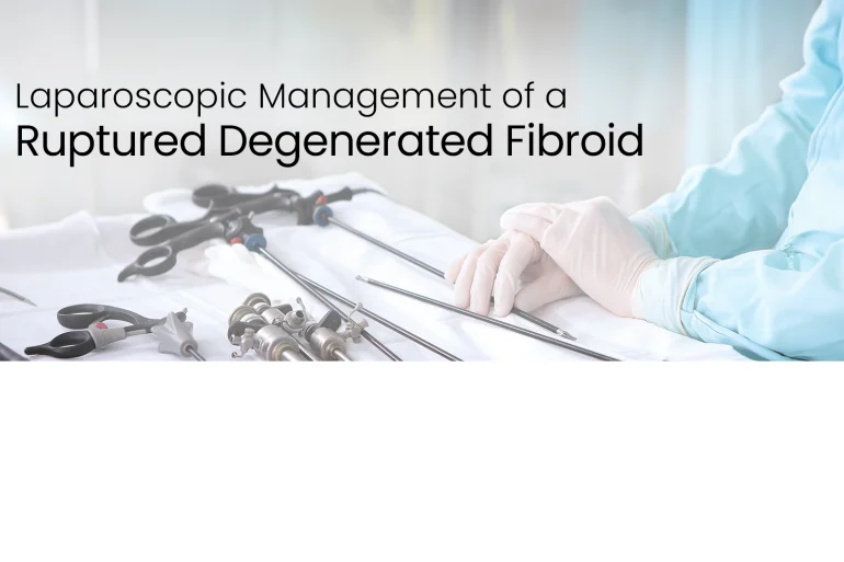 Laparoscopy: Addressing Ruptured Fibroids