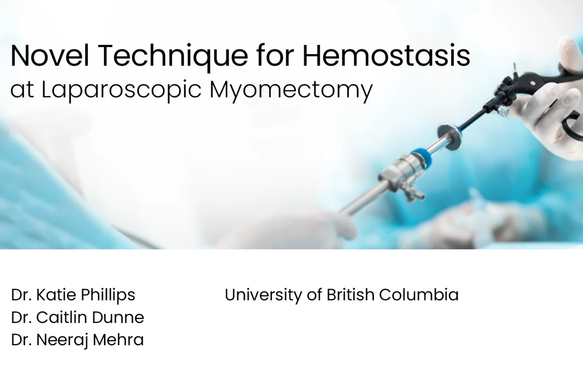 Novel Technique for Hemostasis at Laparoscopic Myomectomy