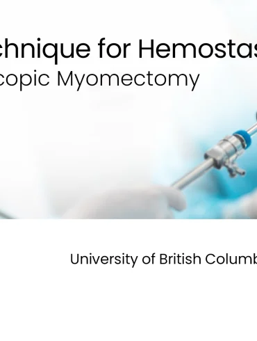 Novel Technique for Hemostasis at Laparoscopic Myomectomy