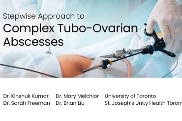 Stepwise Approach to Complex Tubo-Ovarian Abscesses