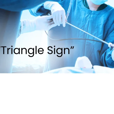 Introducing the Dynamic 'Triangle Sign' Technique