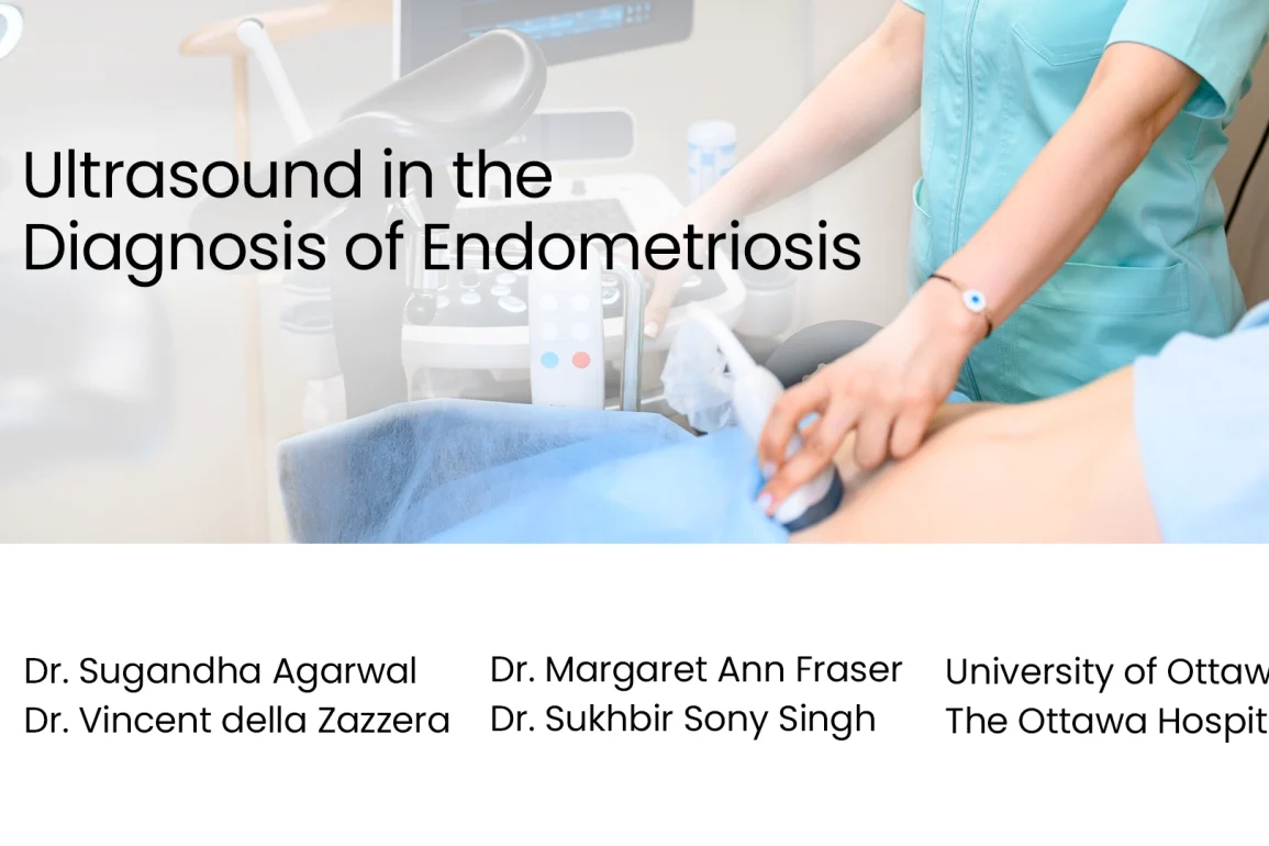 Ultrasound in the Diagnosis of Endometriosis