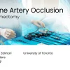 Uterine Artery Occlusion at Myomectomy