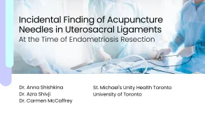 Acupuncture Needles Found During Endometriosis Surgery