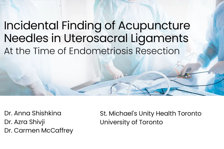 Acupuncture Needles Found During Endometriosis Surgery