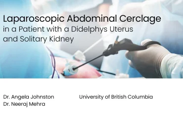Laparoscopic Cerclage: Didelphys Uterus & Solitary Kidney