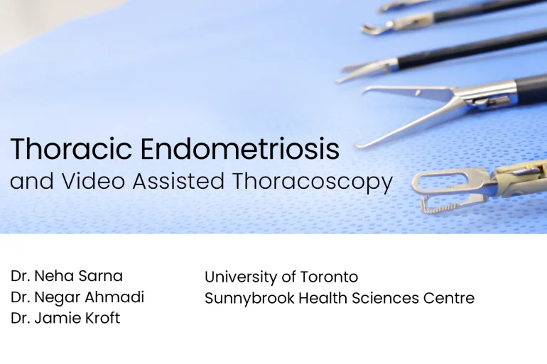 Video-Assisted Thoracoscopy: Thoracic Endometriosis