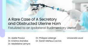 A Rare Case of a Secretory and Obstructed Uterine Horn Fistulized to an Ipsilateral Rudimentary Ureter 65 A Rare Case of a Secretory and Obstructed Uterine Horn Fistulized to an Ipsilateral Rudimentary Ureter