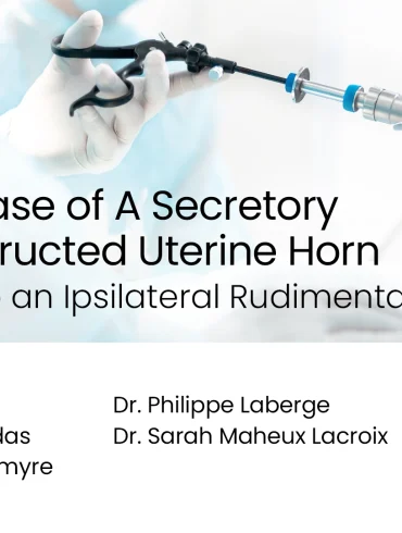 A Rare Case of a Secretory and Obstructed Uterine Horn Fistulized to an Ipsilateral Rudimentary Ureter