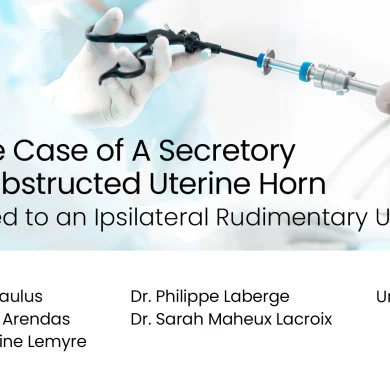 A Rare Case of a Secretory and Obstructed Uterine Horn Fistulized to an Ipsilateral Rudimentary Ureter