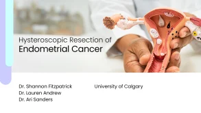 Hysteroscopic Resection of Endometrial Cancer 59 Hysteroscopic Resection of Endometrial Cancer