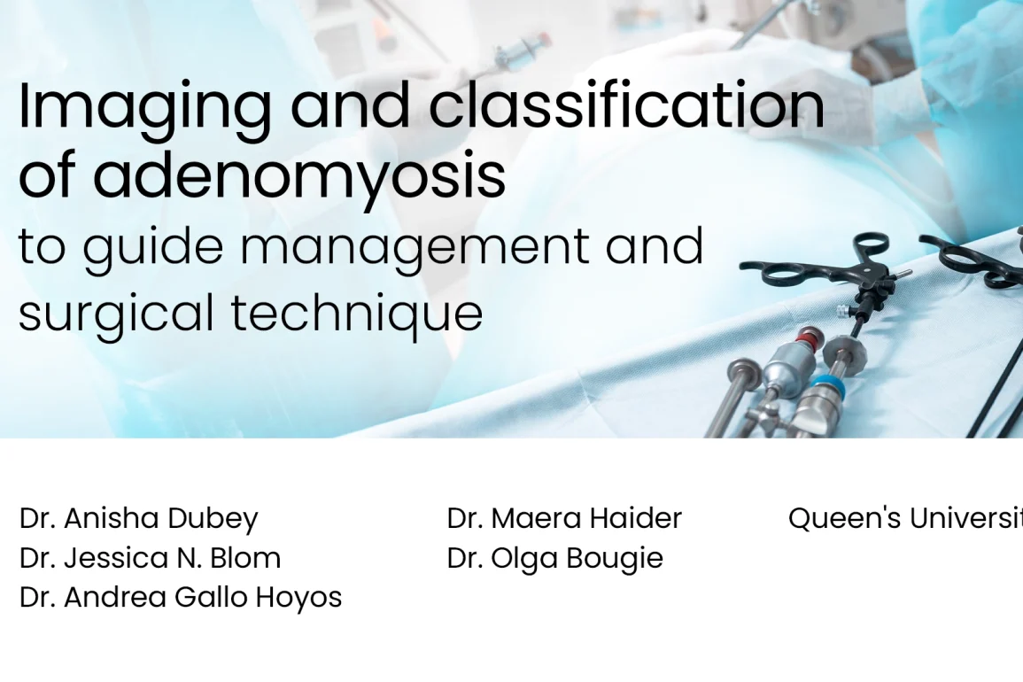 Imaging and Classification of Adenomyosis to Guide Management and Surgical Technique