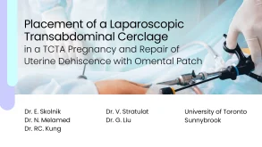 Placement of a Laparoscopic Transabdominal Cerclage in a TCTA Pregnancy and Repair of Uterine Dehiscence with Omental Patch 62 Placement of a Laparoscopic Transabdominal Cerclage in a TCTA Pregnancy and Repair of Uterine Dehiscence with Omental Patch