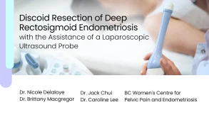 Discoid Resection of Deep Rectosigmoid Endometriosis with the Assistance of a Laparoscopic Ultrasound Probe