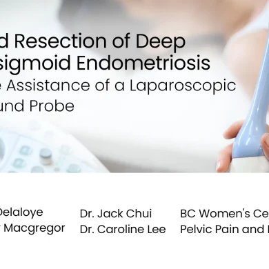 Discoid Resection of Deep Rectosigmoid Endometriosis with the Assistance of a Laparoscopic Ultrasound Probe