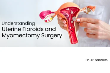 Graphic with Understanding Uterine Fibroids and Myomectomy Surgery written on it